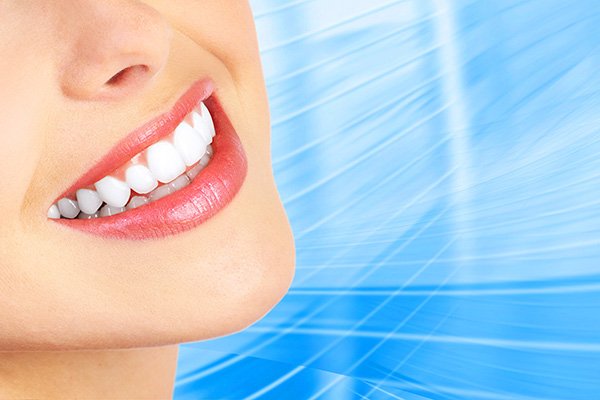 Teeth Whitening: What You Should Know Before Your Treatment