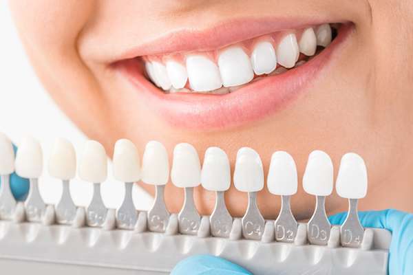 Ask a Cosmetic Dentist: What Are Veneers from Diamond Head Dental Care in Honolulu, HI