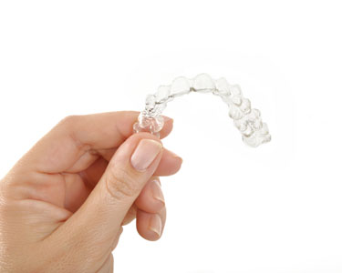 Clear Braces: A Proven Method For Straightening Teeth