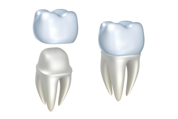 dental implant Honolulu, HI