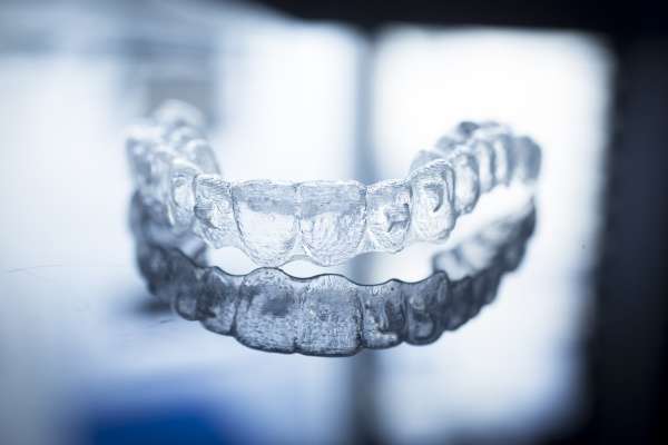 5 Benefits of Invisible Braces or Clear Aligners over Braces