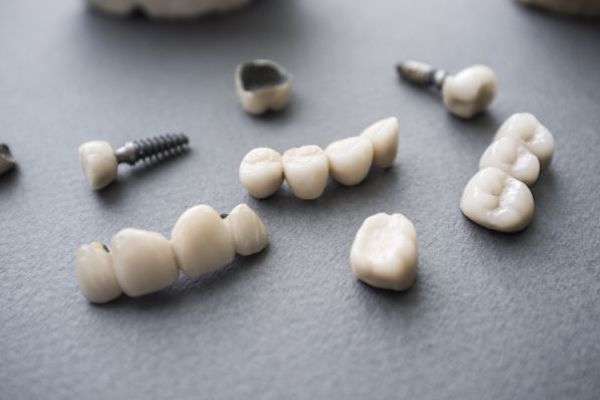 Types of Dental Implants from Diamond Head Dental Care in Honolulu, HI