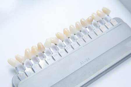 Dental Veneers Dentist In Honolulu Can Ensure Your Teeth Look Natural